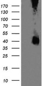 MAP2K3 Antibody in Western Blot (WB)