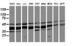 MAP2K3 Antibody in Western Blot (WB)
