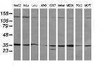 MAP2K3 Antibody in Western Blot (WB)