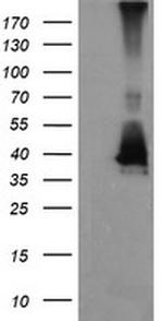 MAP2K3 Antibody in Western Blot (WB)