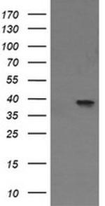 MAP2K3 Antibody in Western Blot (WB)