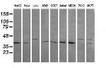 MAP2K3 Antibody in Western Blot (WB)
