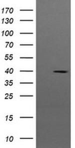 MAP2K3 Antibody in Western Blot (WB)