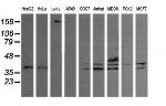 MAP2K3 Antibody in Western Blot (WB)