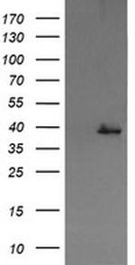 MAP2K3 Antibody in Western Blot (WB)