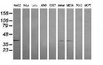 MAP2K3 Antibody in Western Blot (WB)
