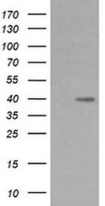 MAP2K3 Antibody in Western Blot (WB)