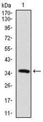 MAP2 Monoclonal Antibody (5B7)