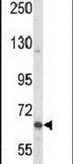 MAP2 Antibody in Western Blot (WB)