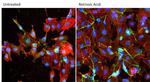 MAP2 Antibody in Immunocytochemistry (ICC/IF)
