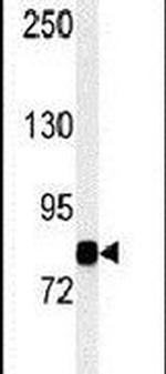 MLK3 Antibody in Western Blot (WB)