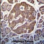 LZK Antibody in Immunohistochemistry (IHC)