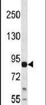 LZK Antibody in Western Blot (WB)
