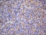 MAP3K8 Antibody in Immunohistochemistry (Paraffin) (IHC (P))
