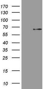 MAP3K8 Antibody in Western Blot (WB)