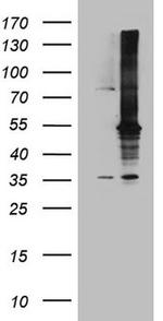 MAP3K8 Antibody in Western Blot (WB)