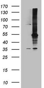 MAP3K8 Antibody in Western Blot (WB)