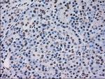 MAPK12 Antibody in Immunohistochemistry (Paraffin) (IHC (P))