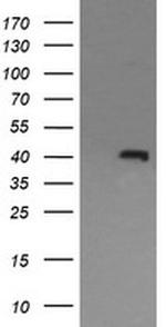MAPK13 Antibody in Western Blot (WB)