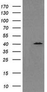 MAPK13 Antibody in Western Blot (WB)
