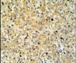 MAPK1IP1L Antibody in Immunohistochemistry (IHC)