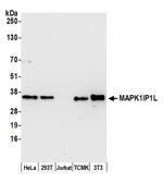 MAPK1IP1L Polyclonal Antibody