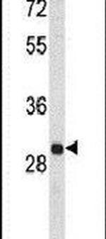 MAPK1IP1L Antibody in Western Blot (WB)