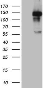MAPK8IP1 Antibody in Western Blot (WB)