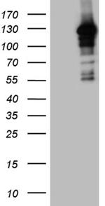 MAPK8IP1 Antibody in Western Blot (WB)