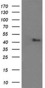 MAPK9 Antibody in Western Blot (WB)
