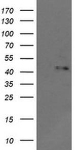 MAPK9 Antibody in Western Blot (WB)