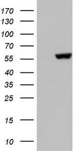 MAPKAPK5 Antibody in Western Blot (WB)
