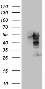 MAPKAPK5 Antibody in Western Blot (WB)