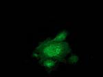 EB2 (MAPRE2) Antibody in Immunocytochemistry (ICC/IF)