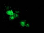 MAPRE2 Antibody in Immunocytochemistry (ICC/IF)