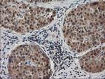 EB2 (MAPRE2) Antibody in Immunohistochemistry (Paraffin) (IHC (P))