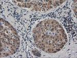 EB2 (MAPRE2) Antibody in Immunohistochemistry (Paraffin) (IHC (P))