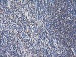 EB2 (MAPRE2) Antibody in Immunohistochemistry (Paraffin) (IHC (P))