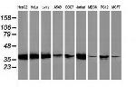EB2 (MAPRE2) Antibody in Western Blot (WB)