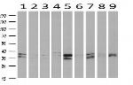 EB2 (MAPRE2) Antibody in Western Blot (WB)