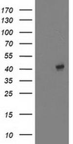 EB2 (MAPRE2) Antibody in Western Blot (WB)