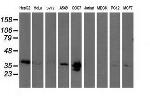 EB2 (MAPRE2) Antibody in Western Blot (WB)