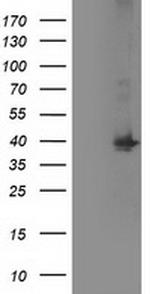 MAPRE2 Antibody in Western Blot (WB)