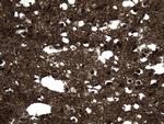 MAPT Antibody in Immunohistochemistry (Paraffin) (IHC (P))
