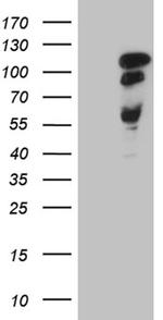 MAPT Antibody in Western Blot (WB)
