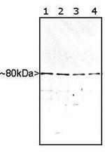 MARCKS Antibody in Western Blot (WB)