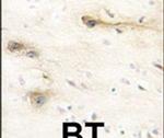 MARK1 Antibody in Immunohistochemistry (IHC)