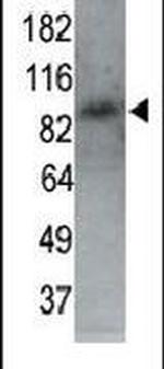 MARK1 Antibody in Western Blot (WB)