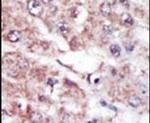 MARK2 Antibody in Immunohistochemistry (IHC)