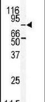 MARK2 Antibody in Western Blot (WB)